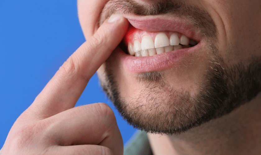 Understanding Periodontal Disease Uncovering Its Causes And Symptoms